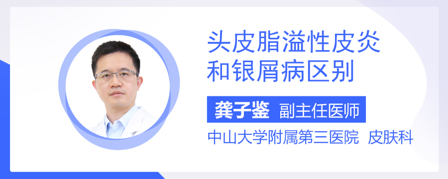 头皮脂溢性皮炎和银屑病区别