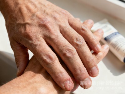 若手汗症状持续时间长、程度严重,或伴随心慌、手抖、体重异常变化、发热等不适症状,应及时就医 若手汗症状持续时间长、程度严重,或伴随心慌、手抖、体重异常变化、发热等不适症状,应及时就医