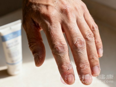 别不当回事 男人左手麻木可能是身体“报警” 这些潜在问题要排