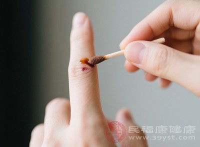 每天观察伤口变化，正常情况下，蹭掉结痂后的伤口会逐渐从淡红色转为肤色，1-2周内慢慢愈合