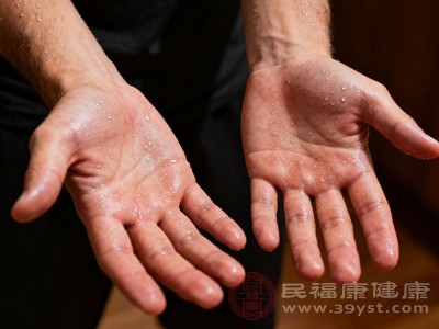 汗疱疹 属于湿疹的一种特殊类型,好发于手掌、手指侧面及指端,对称分布 汗疱疹 属于湿疹的一种特殊类型,好发于手掌、手指侧面及指端,对称分布