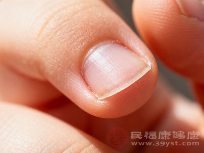 一些皮肤疾病也会导致孩子手指头脱皮