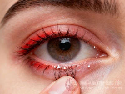 高血压、糖尿病等全身性疾病可能影响眼部血管健康，导致眼睛充血