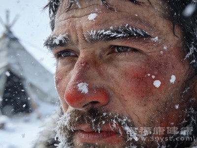 冻伤急救+就诊指南：别再挂错科，烧伤科诊疗更专业