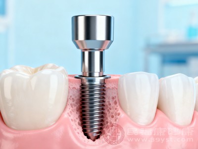 与活动假牙相比,种植牙通过植入牙槽骨内的种植体作为“牙根”,能像天然牙一样承受咀嚼压力,咀嚼效率可达活动假牙的80%以上 与活动假牙相比,种植牙通过植入牙槽骨内的种植体作为“牙根”,能像天然牙一样承受咀嚼压力,咀嚼效率可达活动假牙的80%以上