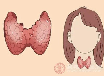 随着病理医学的发展,甲状腺癌的诊断标准不断优化,过去被归为良性的部分病变,如今通过免疫组化等精准检测技术被明确诊断为早期甲状腺癌 随着病理医学的发展,甲状腺癌的诊断标准不断优化,过去被归为良性的部分病变,如今通过免疫组化等精准检测技术被明确诊断为早期甲状腺癌