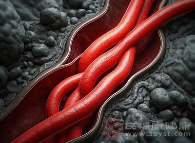 年轻人若存在高血压、高血脂等基础疾病,会损伤血管内皮,导致血管狭窄或痉挛,影响脑部和眼部的血液供应,引发一过性黑蒙 年轻人若存在高血压、高血脂等基础疾病,会损伤血管内皮,导致血管狭窄或痉挛,影响脑部和眼部的血液供应,引发一过性黑蒙