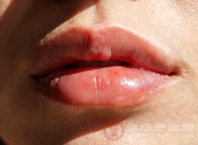 这种口渴可能伴随口苦、食欲不振、右上腹不适等症状