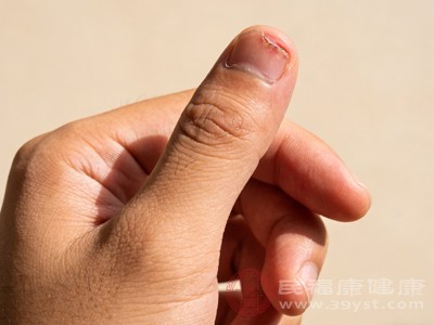 90%的人都错了！长倒刺和维生素没关系，做好这几点就消失