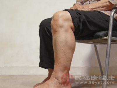 老年人腿肿成因与治疗全解析 看完少走弯路