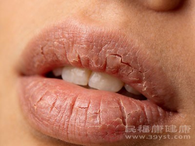 可能是疾病的外在表现