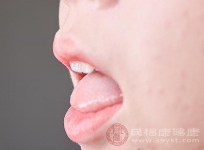 吃樱桃会上火吗 真相是“吃对量才是关键”