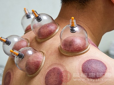 痧象的辨证意义 痧象的辨证意义