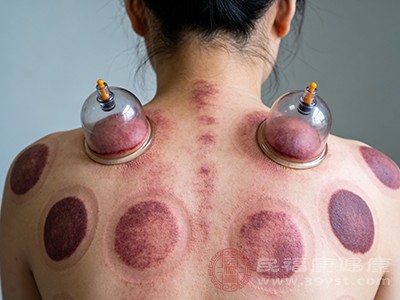 出痧≠排毒 开背背后的秘密 看完不再交智商税