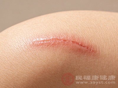 严重的还能手术配合术后措施精准打击