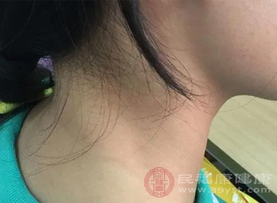 扁桃体肥大可能会压迫咽部，引起异物感