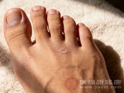 女性在生理期、孕期、哺乳期等特殊阶段，体内激素水平变化较大，气血易相对不足，也可能出现脚冰凉的情况