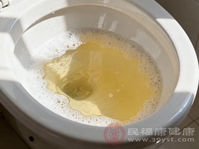 剧烈运动后，身体会通过出汗流失大量水分，导致尿液浓缩，颜色变深