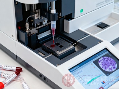 肌红蛋白低藏着身体小秘密 一文拆解常见原因与科学改善策略