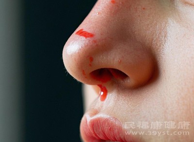 增加鼻出血的几率