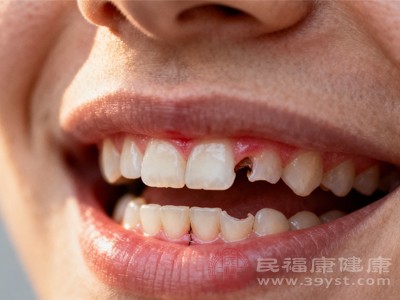 牙齿的矿化程度、形态结构也会影响蛀牙洞的发生