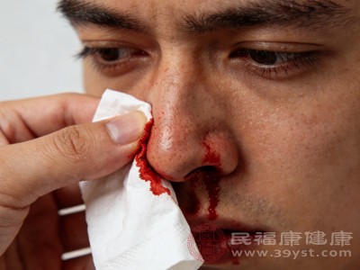 肝肾功能异常的患者，由于凝血因子合成减少或代谢障碍，也可能出现鼻出血症状