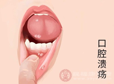 一到换季就嘴烂记住这几点 吃饭不疼说话不费劲好得快