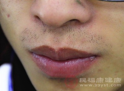 当拔胡子引发毛囊感染或皮肤炎症时，身体免疫系统会启动防御机制，附近的淋巴结（如下颌淋巴结、颈部淋巴结）会出现反应性肿大，表现为皮下可触及的小硬结，伴随轻微压痛