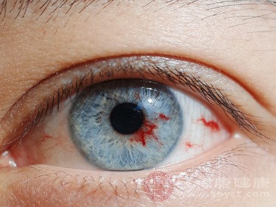 为啥眼睛会突然出现红血块 是眼底出血吗 答案比你想的简单