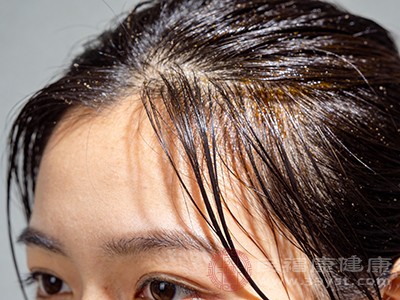 头皮越洗越油的秘密 90%的人都做错了