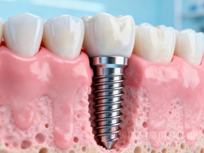 牙齿因外伤、感染等导致牙髓坏死，或进行根管治疗后，牙齿失去牙髓提供的营养供应，牙体组织会逐渐变得干燥、脆弱