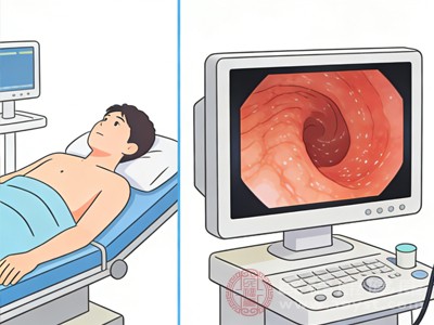 若腹泻持续不缓解,需及时就医,通过粪便常规、肠镜、血液检查等明确病因 若腹泻持续不缓解,需及时就医,通过粪便常规、肠镜、血液检查等明确病因
