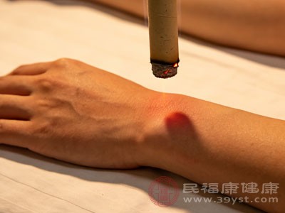 内关穴在前臂前区