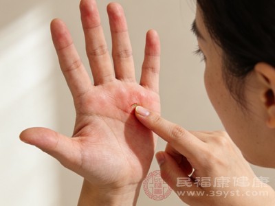 按摩时力度要适中,以感到酸胀为宜,不可用力过猛,以免损伤手指皮肤、关节或神经 按摩时力度要适中,以感到酸胀为宜,不可用力过猛,以免损伤手指皮肤、关节或神经