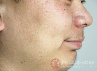 部分轻度低血糖患者会出现口唇周围麻木的感觉