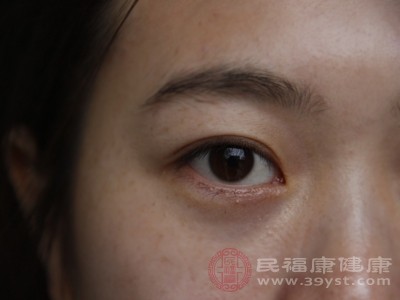 全身性疾病的“眼部表现”