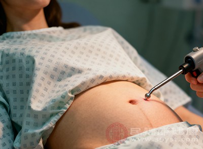 做完腹腔镜手术别大意 这些“护己指南”速速收好