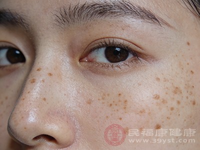 祛斑霜是“智商税”还是真有用 一文带你看透真相