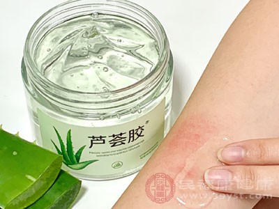 芦荟胶是天然的消肿止痒好物
