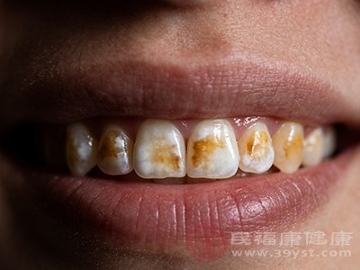 饮用水中氟含量过高，可能引发氟斑牙，使牙齿表面出现白垩色或黄褐色斑块。