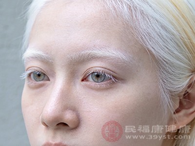 疾病导致的色素异常