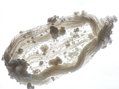 其他病原体感染的可能性