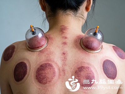 惊 刮痧拔罐后出痧竟是身体在“发信号”