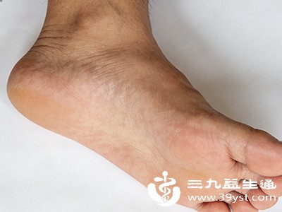 别小瞧扁平足 这些危害正在悄悄“找上门”