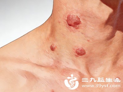 脖子上的小肉粒在说话 听听它咋说