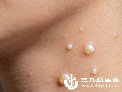 脂肪粒外观多为白色