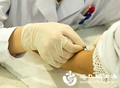 通常建议在月经周期的第21天左右（黄体期）进行检测，以准确评估黄体功能