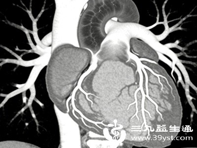 冠状动脉是为心脏供血的重要血管，一旦出现狭窄或堵塞，就可能导致心肌缺血