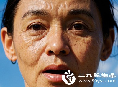 不良的生活习惯也在潜移默化中影响着皮肤状态，增加老人斑出现的几率