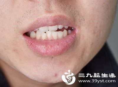 引发更严重口腔问题 引发更严重口腔问题